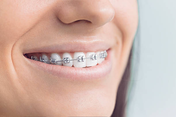 Best Teeth Whitening  in Cade, LA